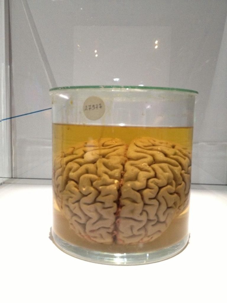 Neurones les intelligences simulées : where is my mind cerveau